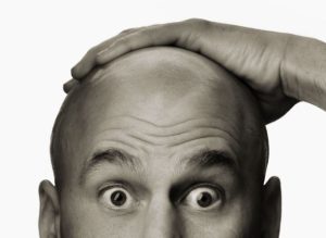 hair loss bald