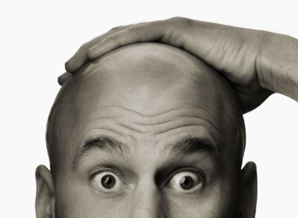 hair loss bald